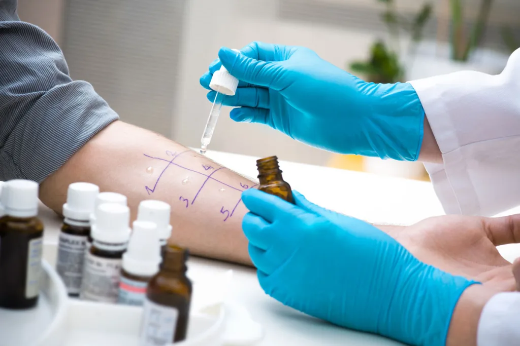 Heuschnupfen Allergietest